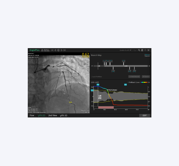 Angio Plus® - μFR, Quantitative Flow Ratio