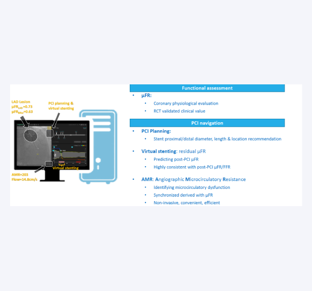 Angio Plus® - μFR, Quantitative Flow Ratio