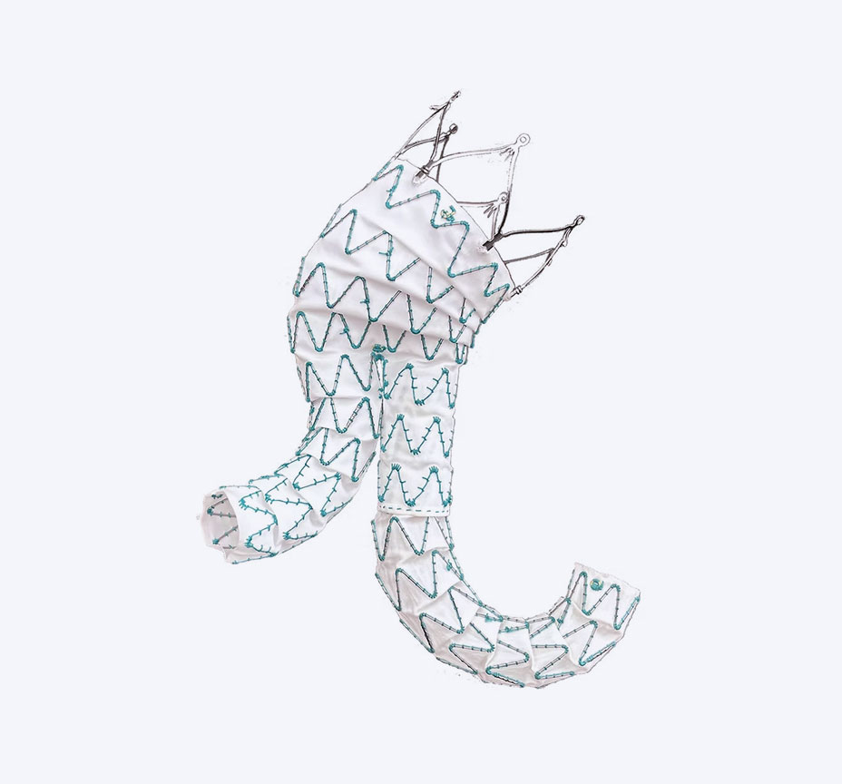 Percutek® AAA - Abdominal Endoprosthesis Stent-Graft